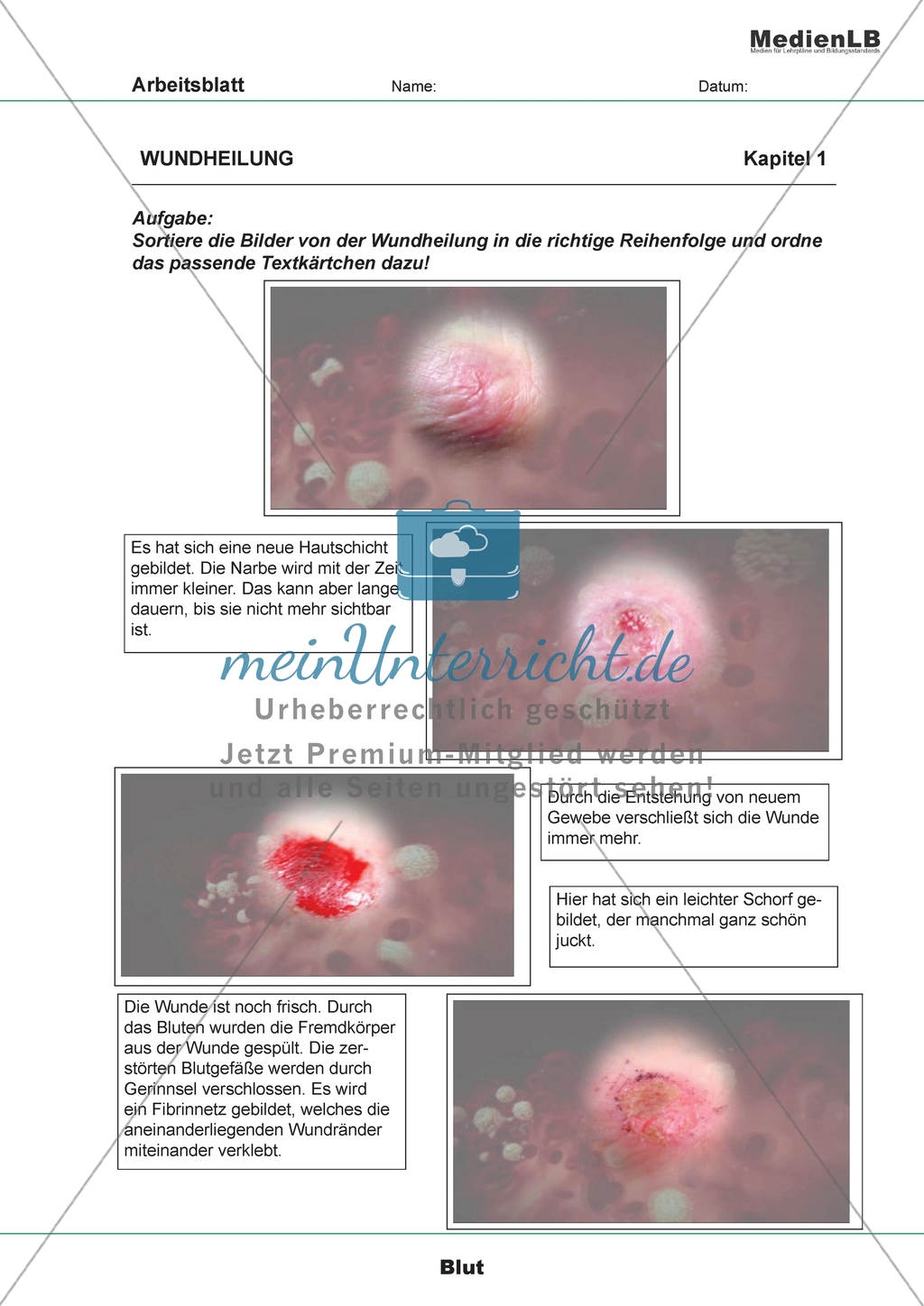 Wundheilung - Bilder und Textkärtchen ordnen Preview 1