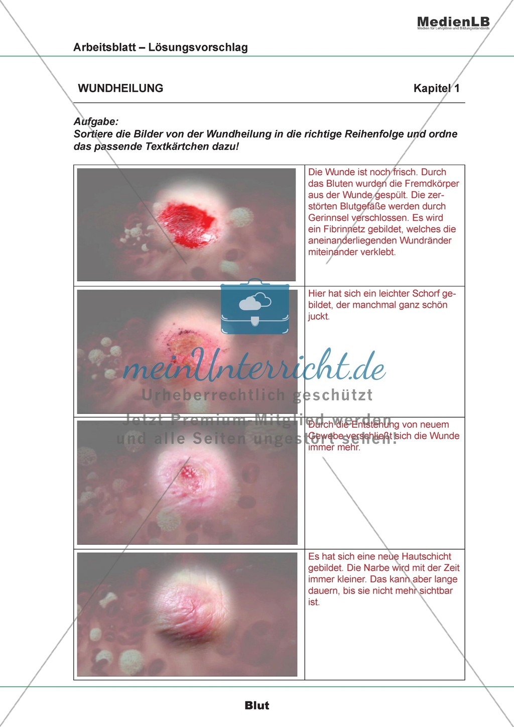 Wundheilung - Bilder und Textkärtchen ordnen Preview 2