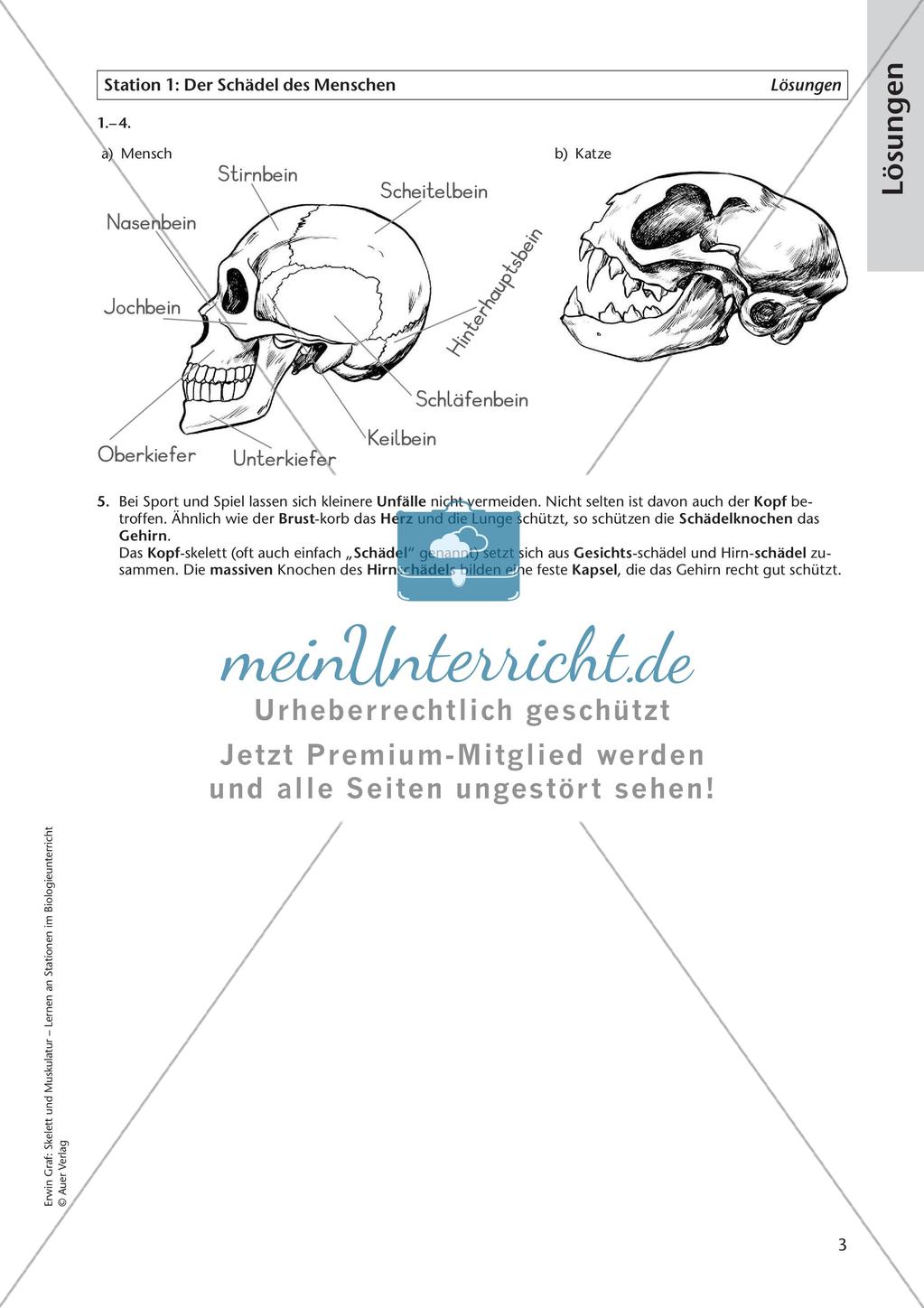 Der Schädel des Menschen Preview 5