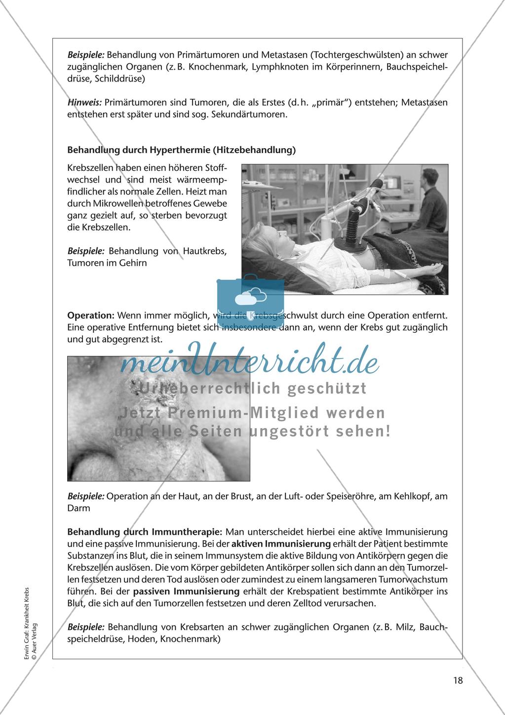 Grundlagen: Krankheit Krebs Preview 20
