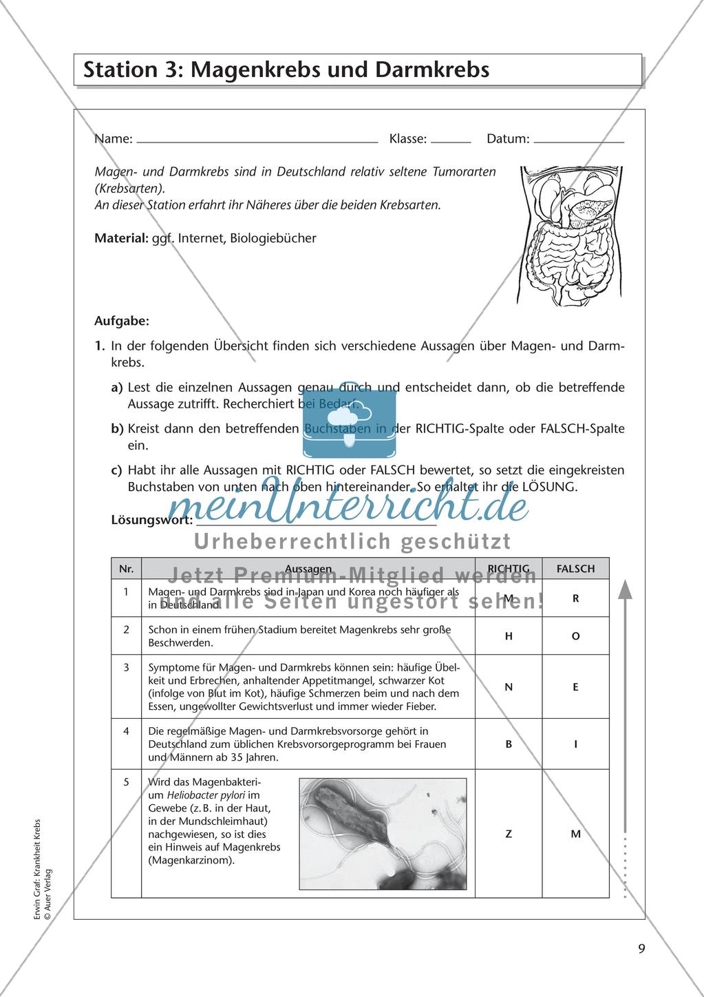Bekannte Krebsarten Preview 11