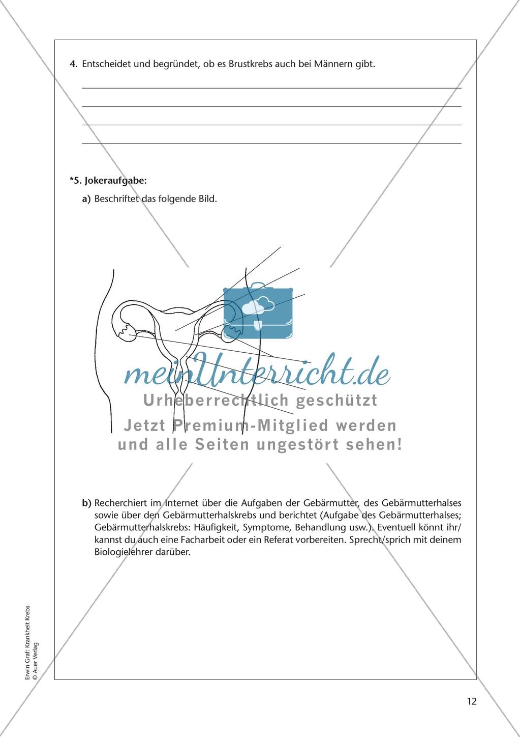Bekannte Krebsarten Preview 14