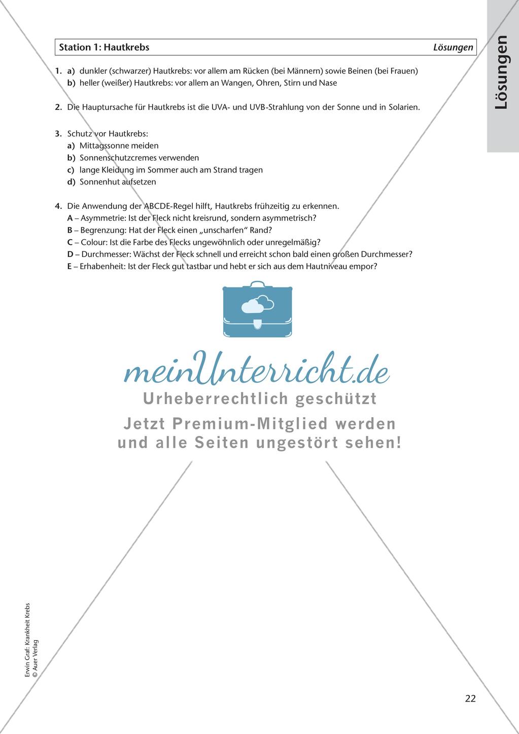 Bekannte Krebsarten Preview 24