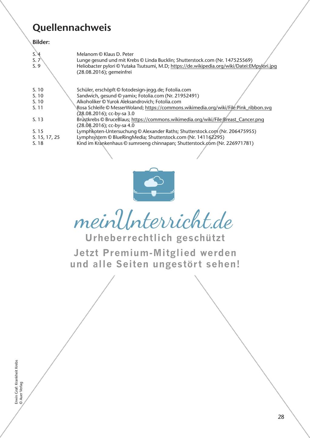 Bekannte Krebsarten Preview 30