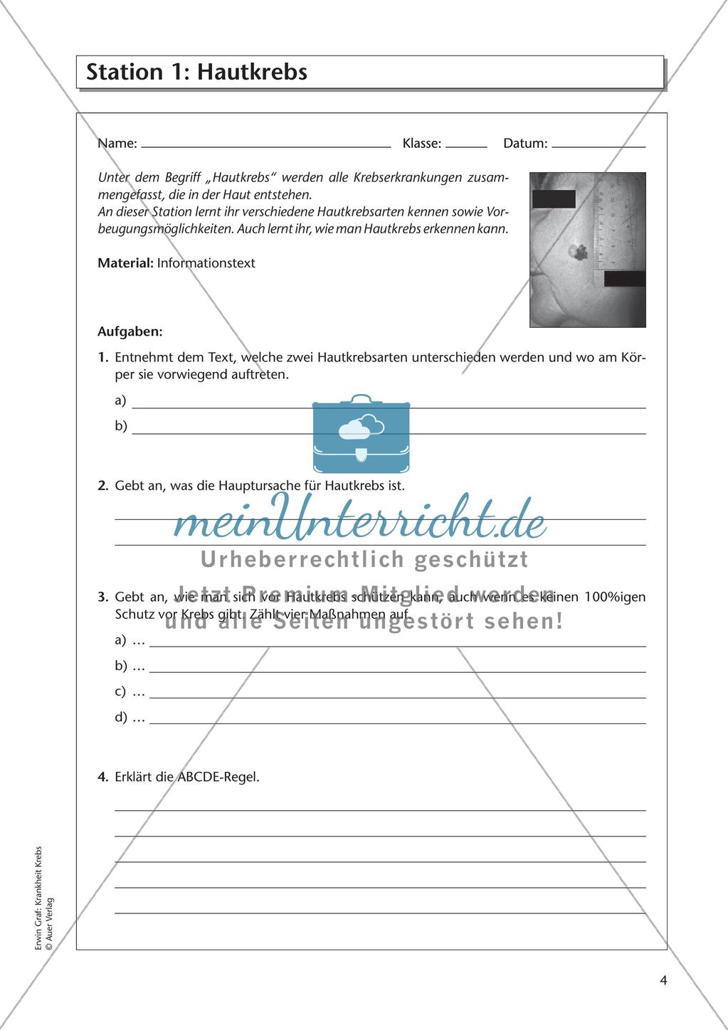 Bekannte Krebsarten Preview 6