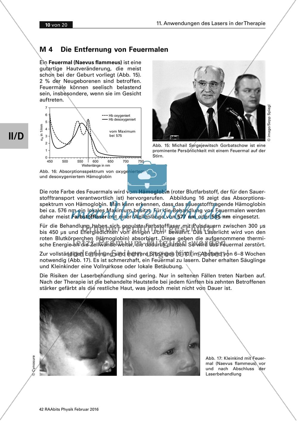 Physik und Medizin: Anwendungen des Lasers Preview 10