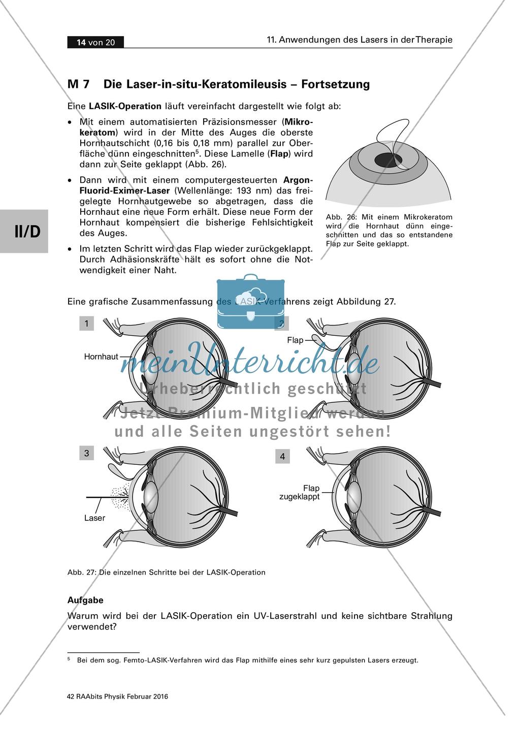 Physik und Medizin: Anwendungen des Lasers Preview 14