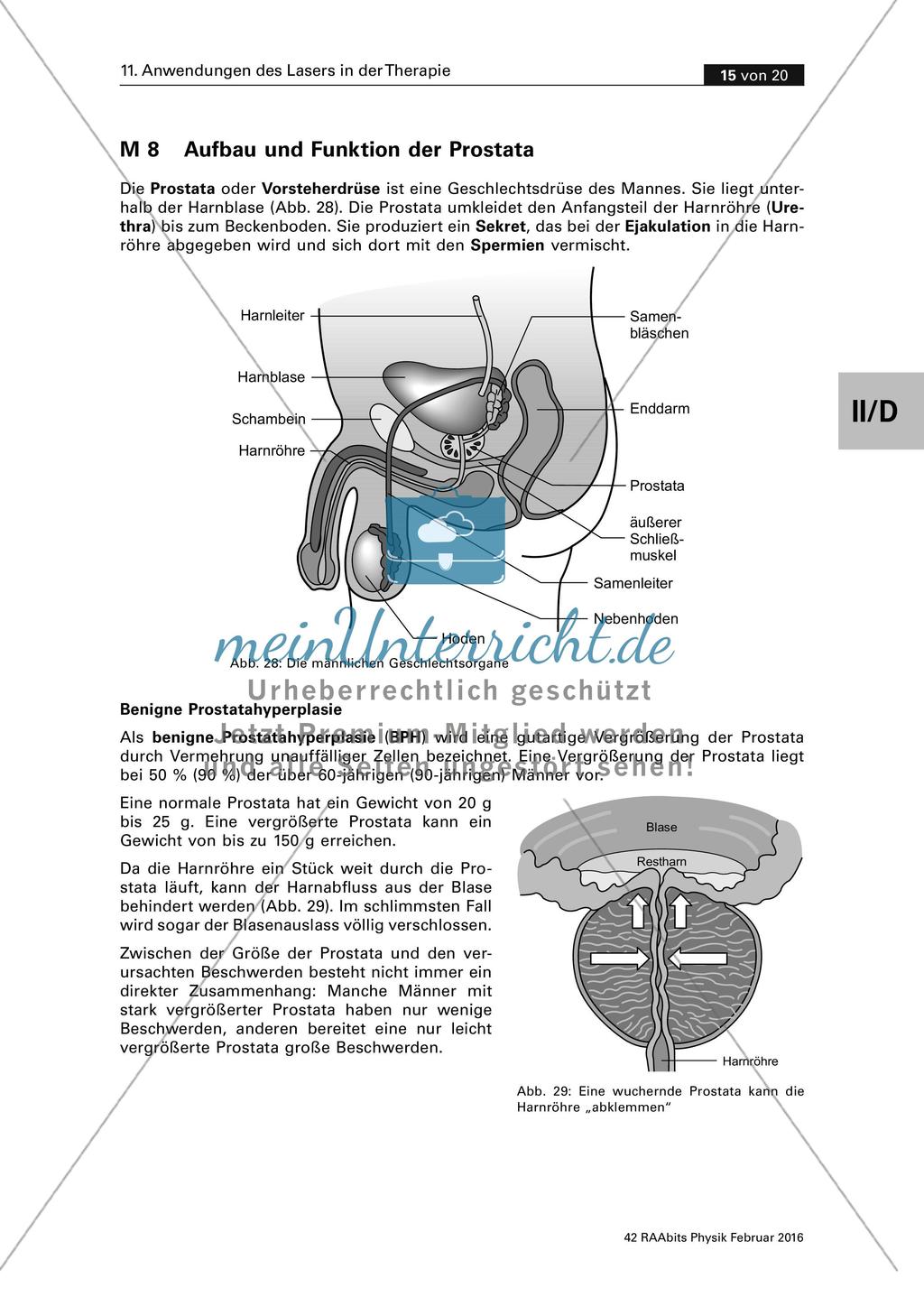 Physik und Medizin: Anwendungen des Lasers Preview 15