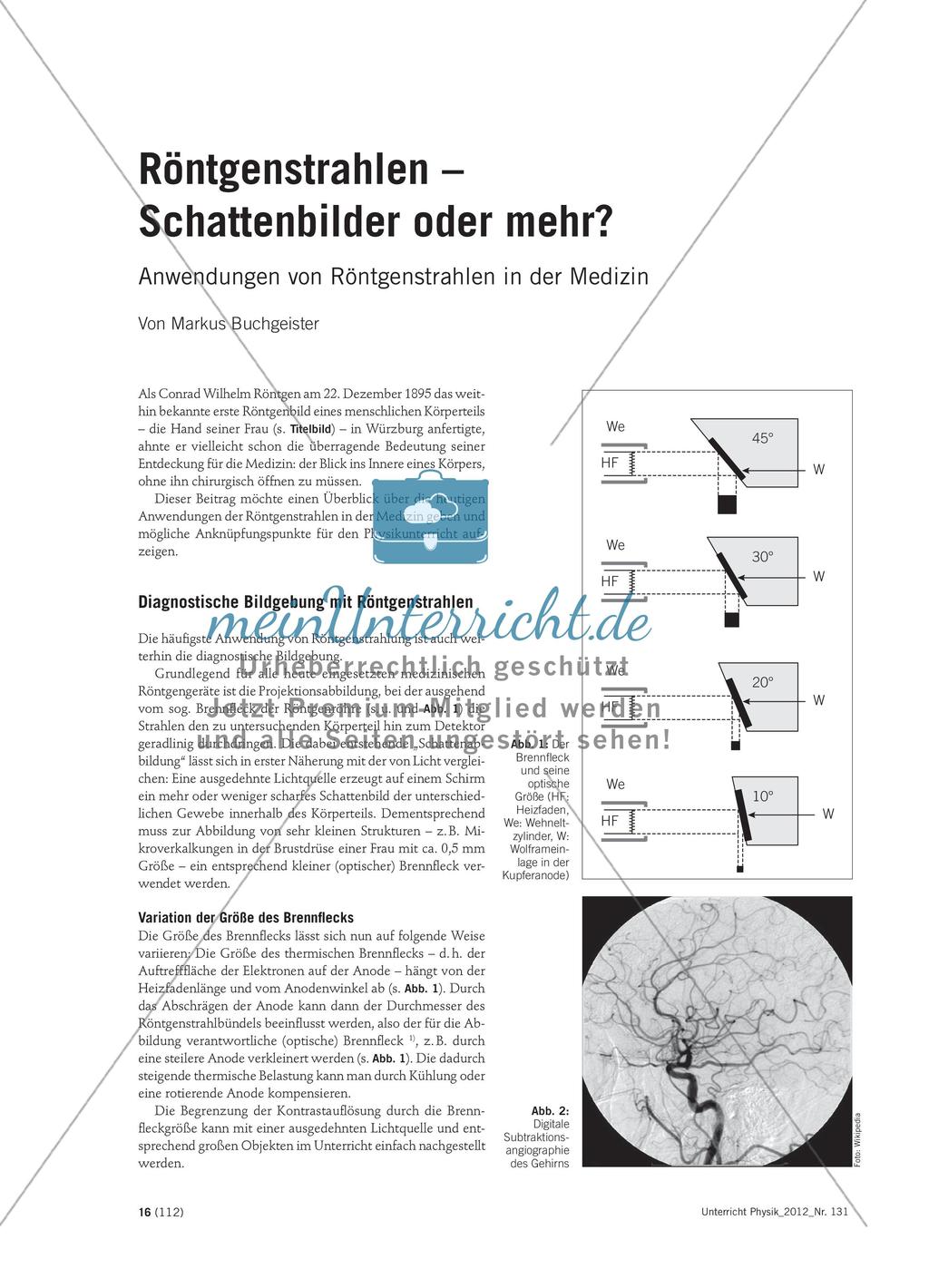 Röntgenstrahlen – Schattenbilder oder mehr?: Anwendungen von Röntgenstrahlen in der Medizin Preview 1
