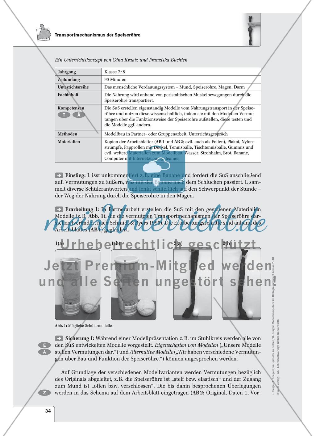 Transportmechanismus der Speiseröhre Preview 1