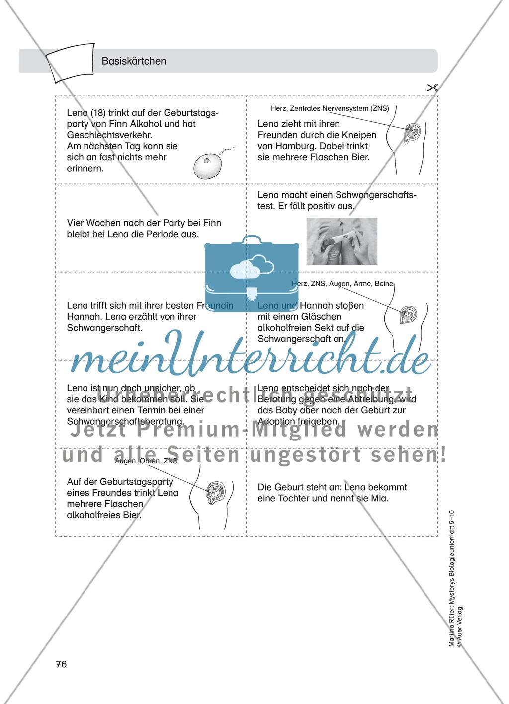 Alkoholmissbrauch – Fetales Alkoholsyndrom Preview 4