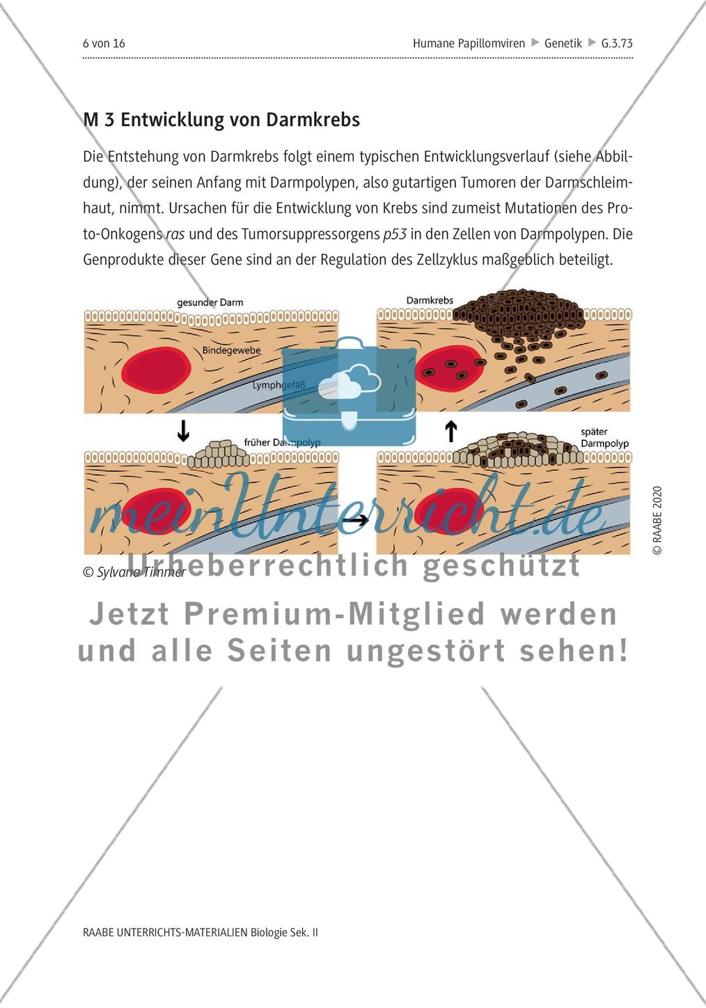 Gebärmutterhalskrebs durch Humane Papillomviren Preview 10