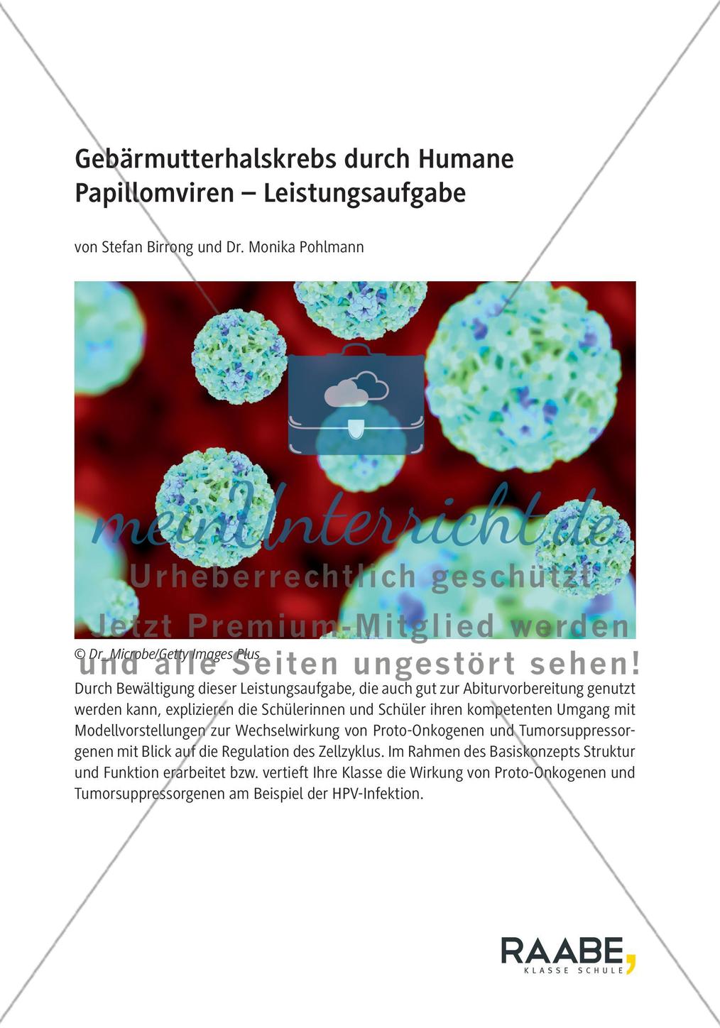 Gebärmutterhalskrebs durch Humane Papillomviren Preview 1