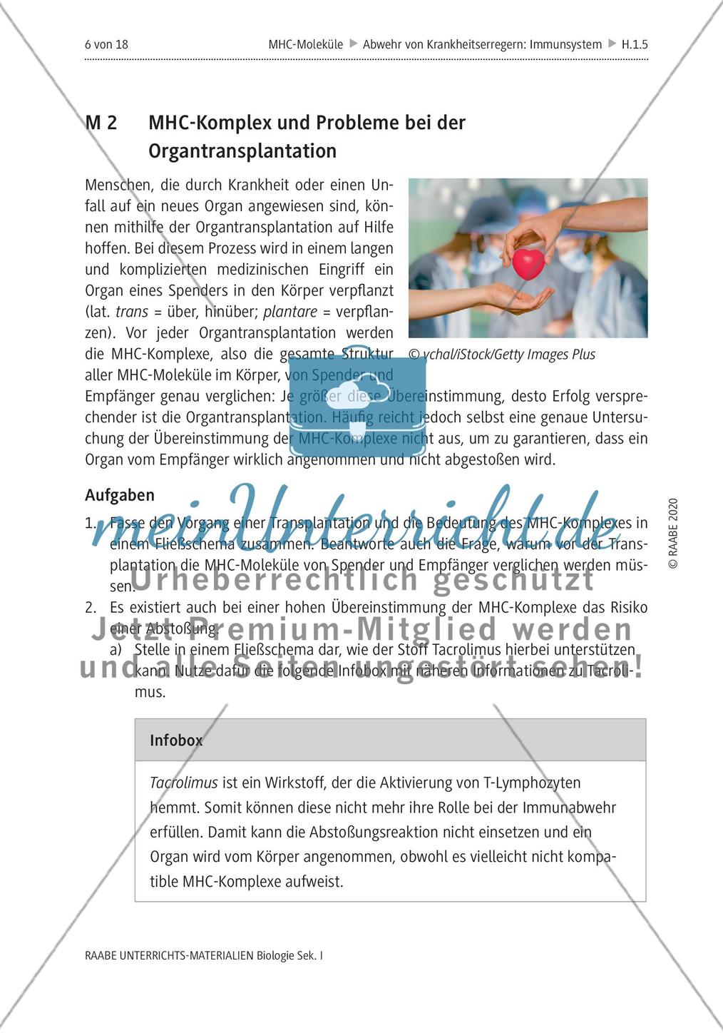 MHC-Komplex und Probleme bei der Organtransplantation Preview 1
