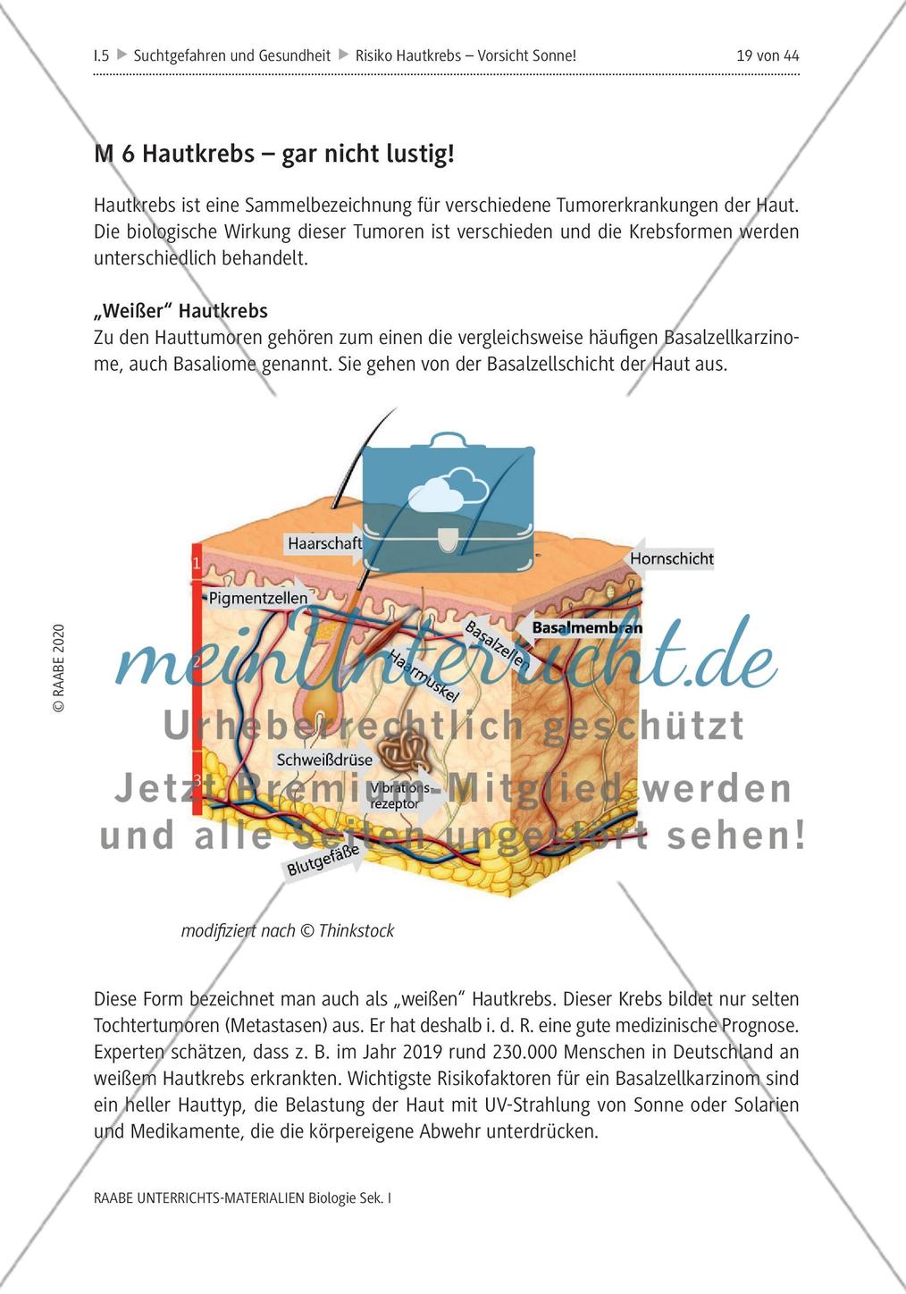 Risiko Hautkrebs - M4-M6 Preview 7