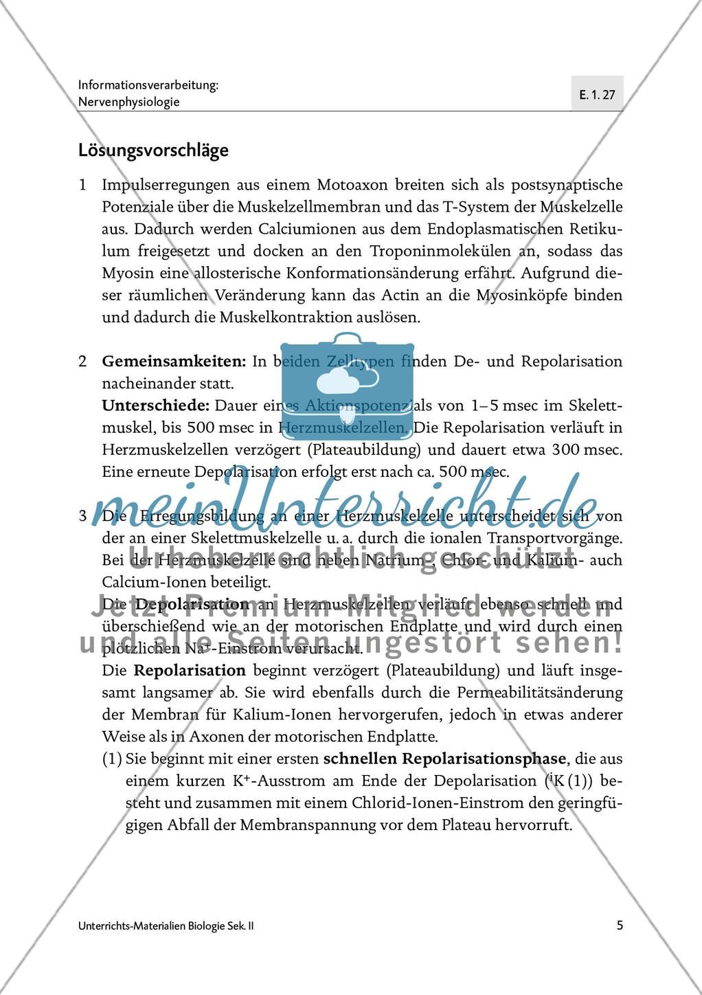 Romano-Ward-Syndrom (RWS) Preview 6