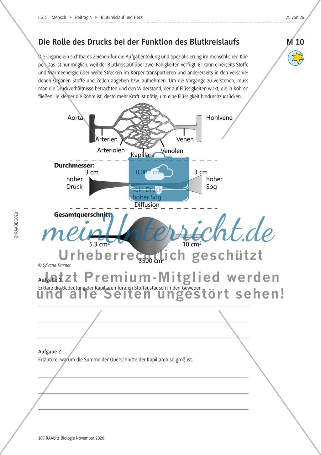 Einflüsse der Lebensführung auf die Gesundheit des Herz-Kreislauf-Systems / Untersuchung und Präparation eines Schweineherzens / Blutplasma durchspült das Gewebe Preview 3