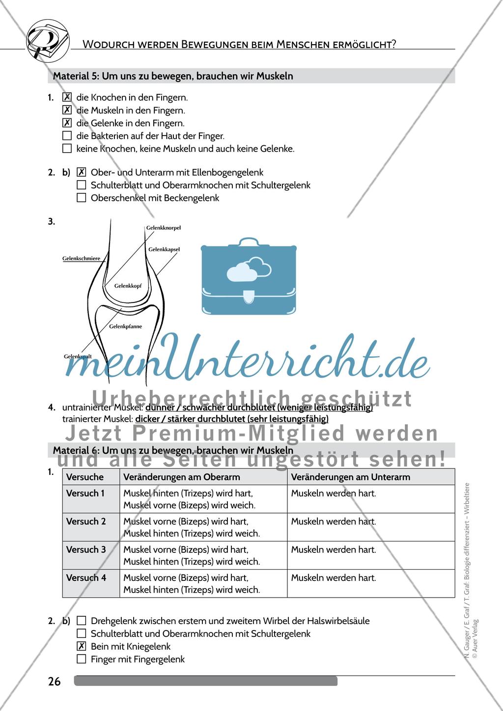 Wodurch werden Bewegungen beim Menschen ermöglicht? Preview 13