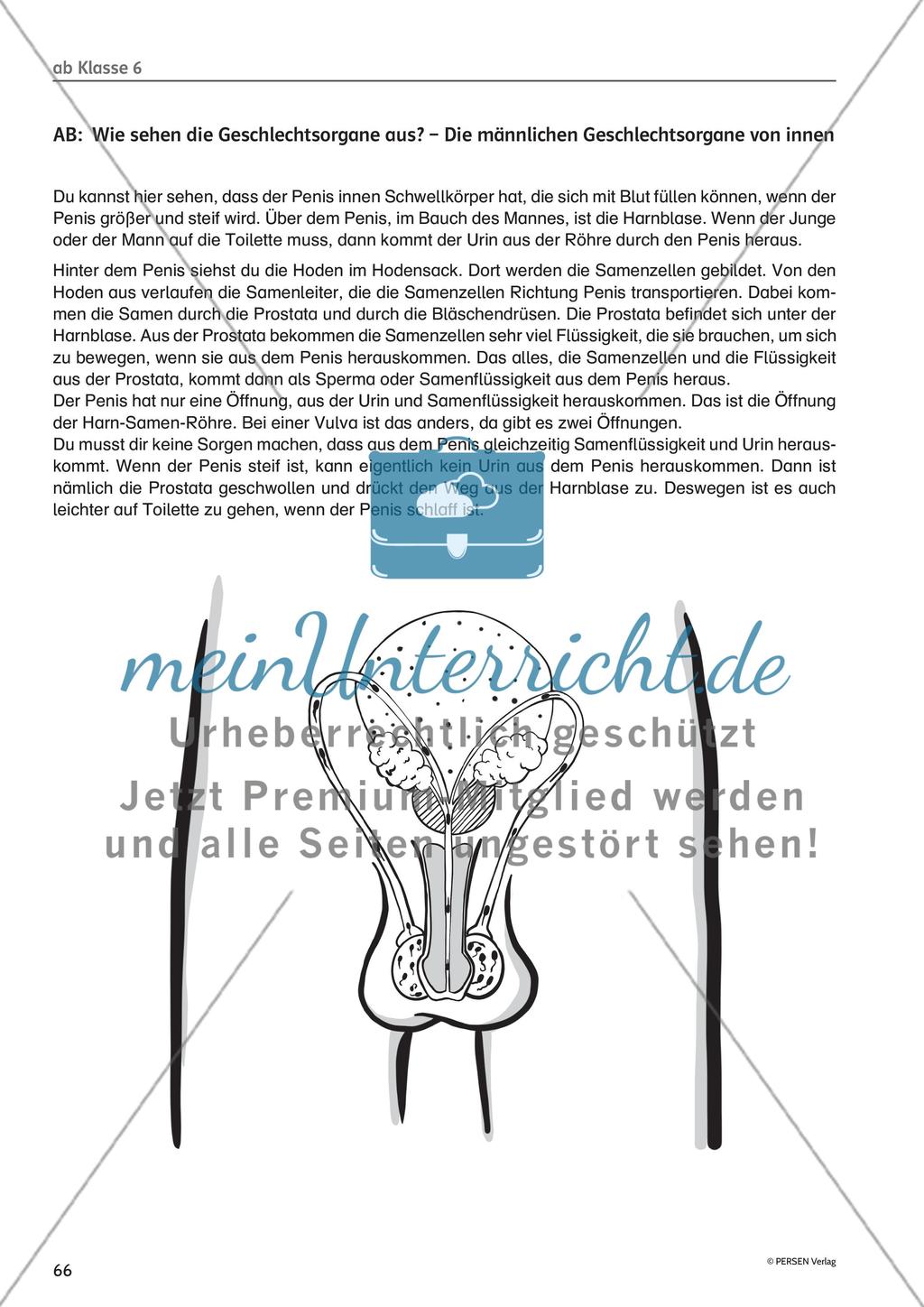 Methodisches für die Unterrichtspraxis: Hinweise und Arbeitsmaterial - Teil 3 Preview 10