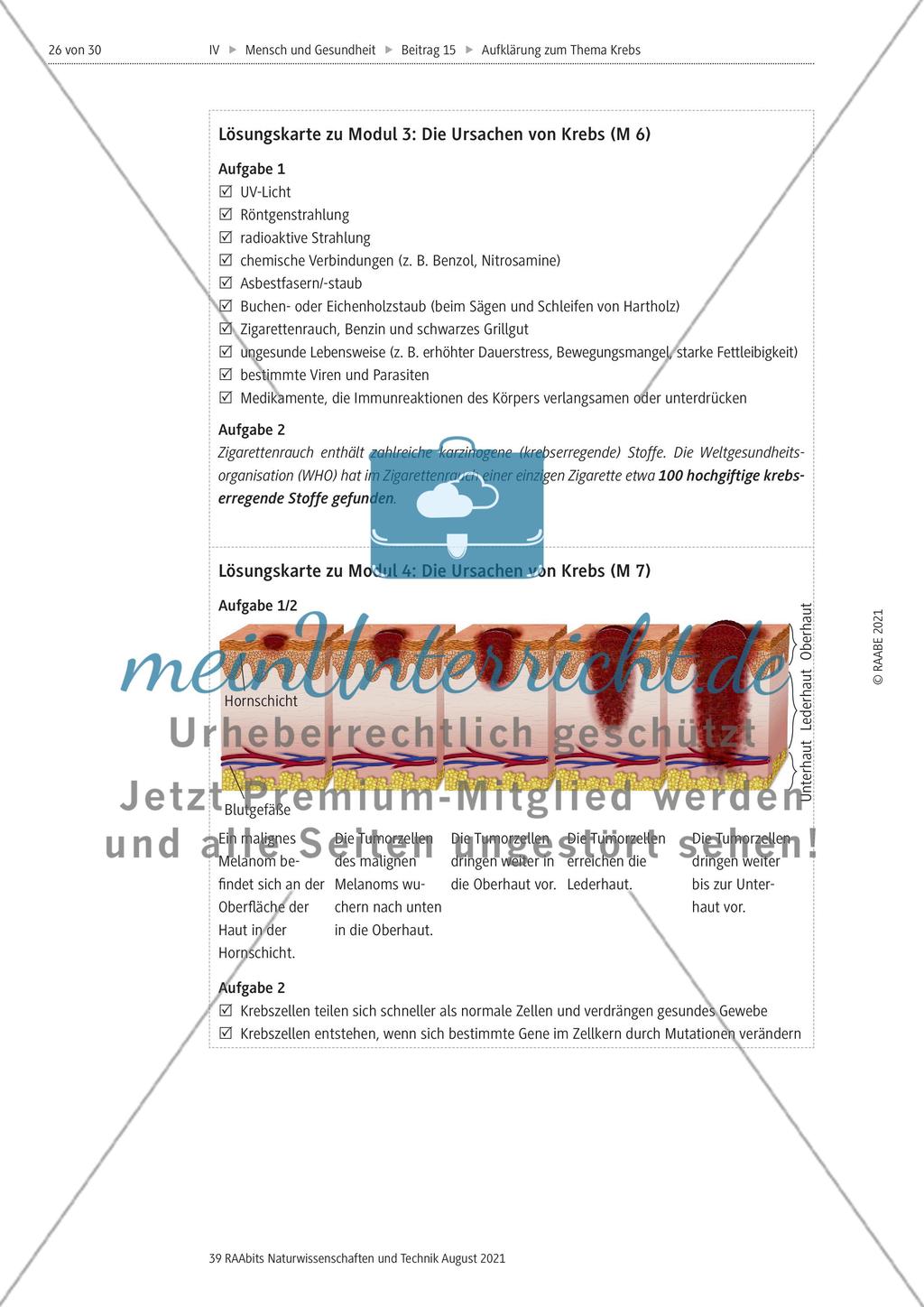 Alles zum Thema Krebs - Stationenlernen Preview 14