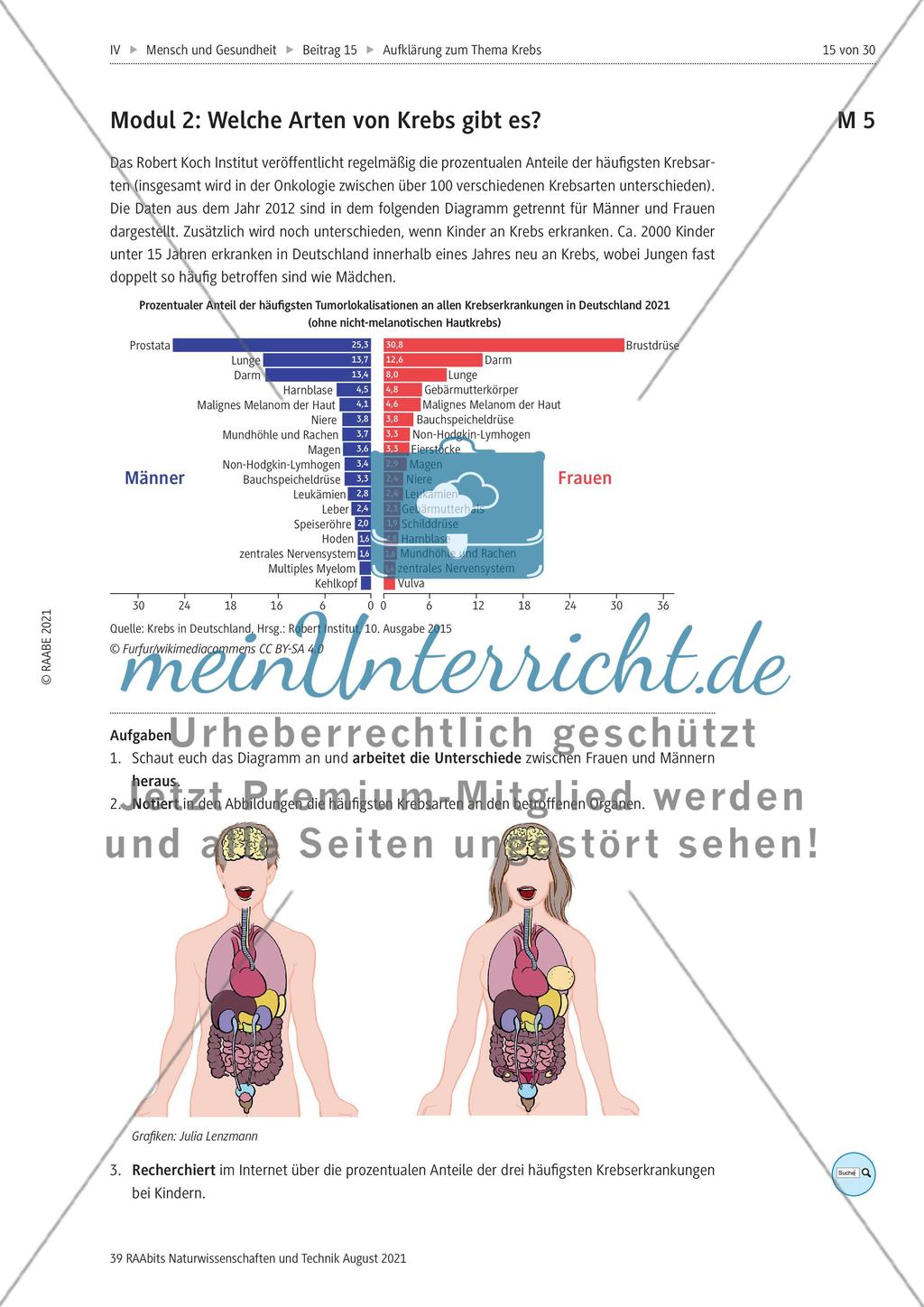 Alles zum Thema Krebs - Stationenlernen Preview 3