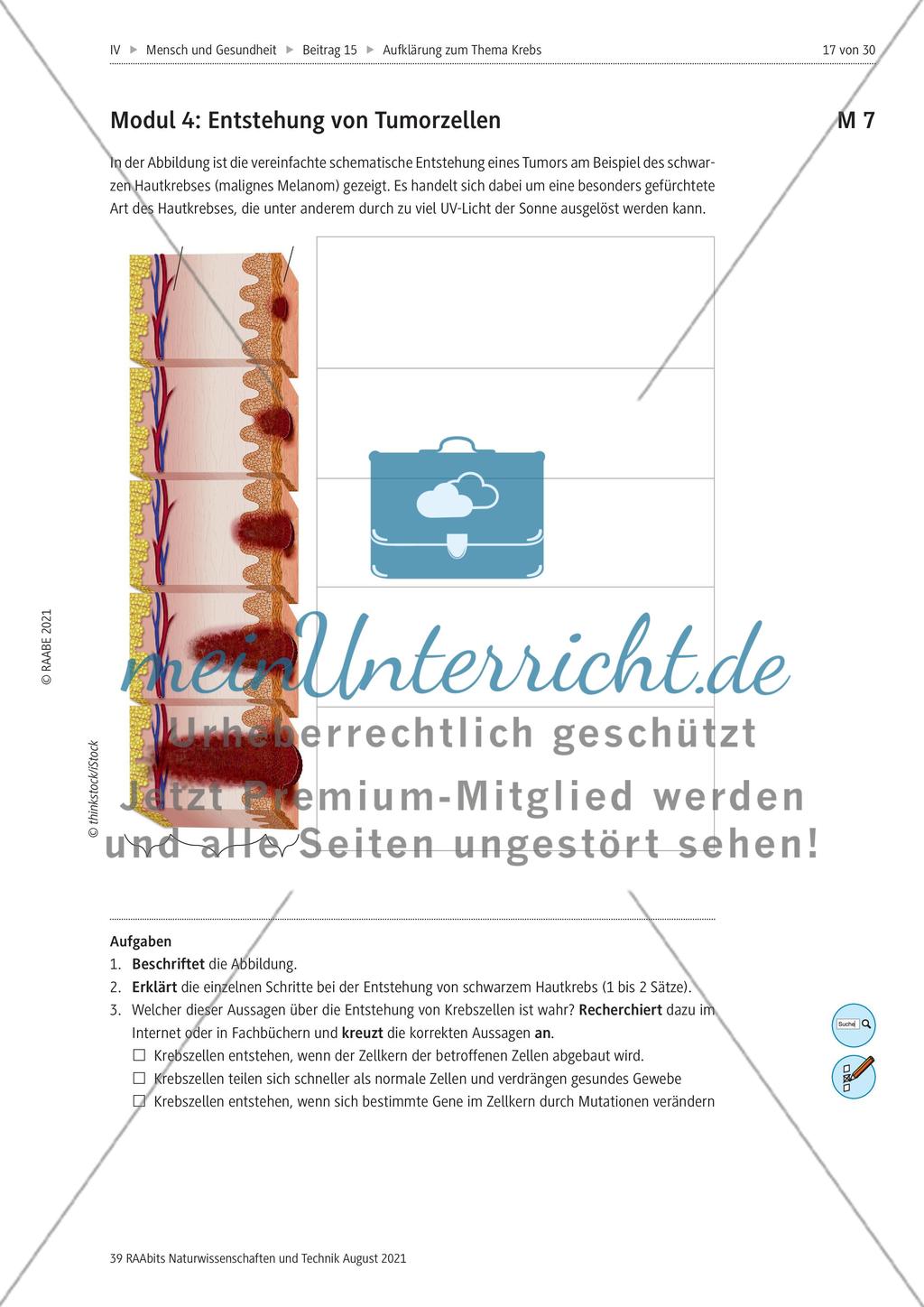Alles zum Thema Krebs - Stationenlernen Preview 5