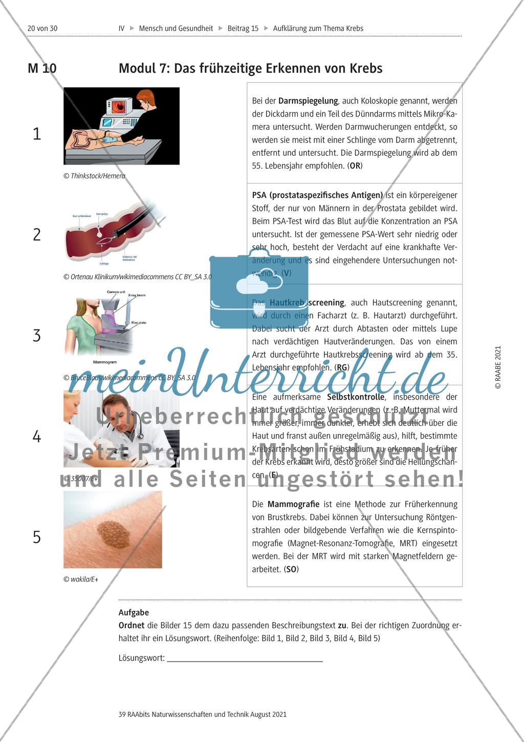 Alles zum Thema Krebs - Stationenlernen Preview 8