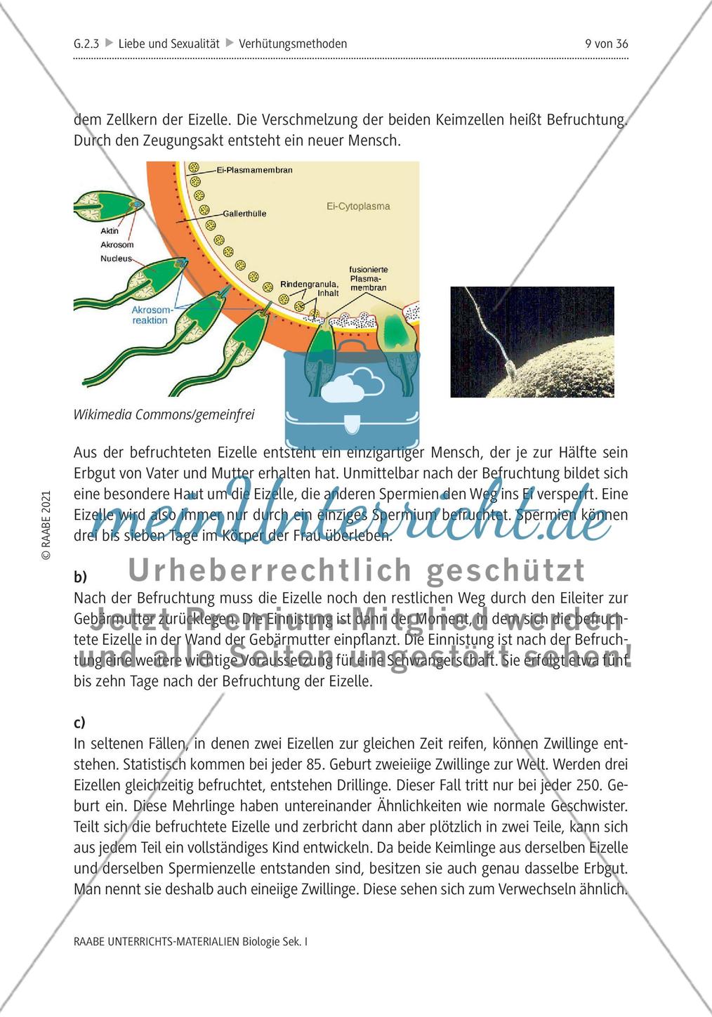 Ist Verhütung Frauensache? - M1-M5 Preview 5