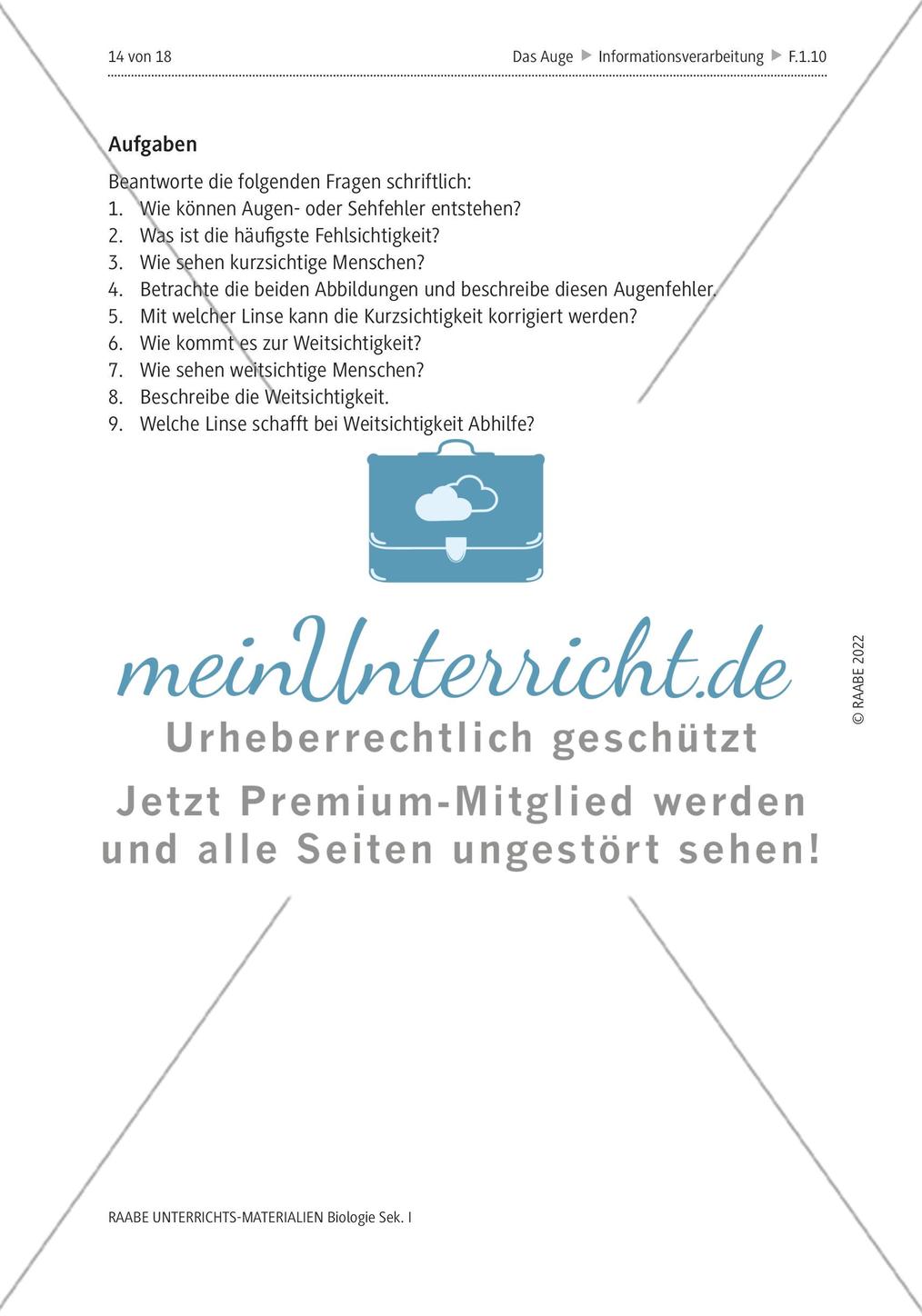 Das menschliche Auge und die Gefährdung durch Smartphones Preview 11