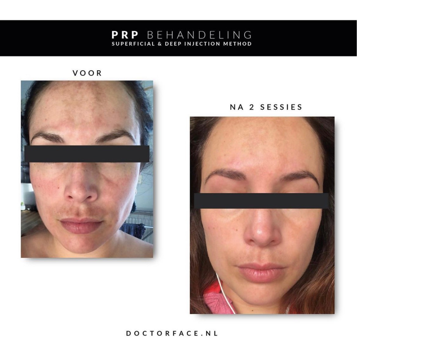 slide thumbnail 2