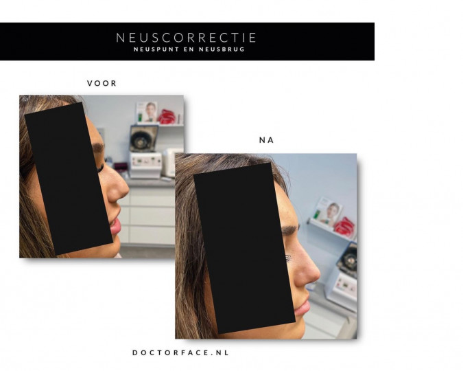 slide afbeelding 6