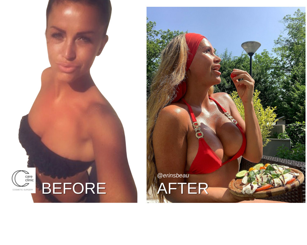 slide thumbnail 2