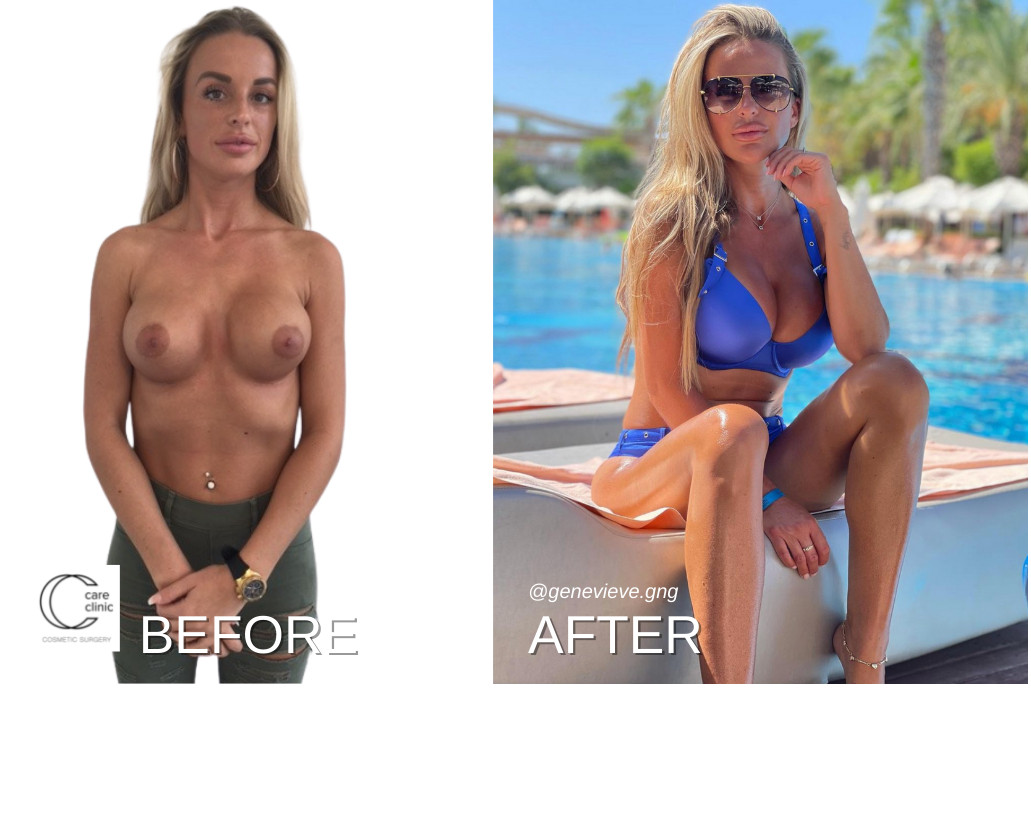 slide thumbnail 3
