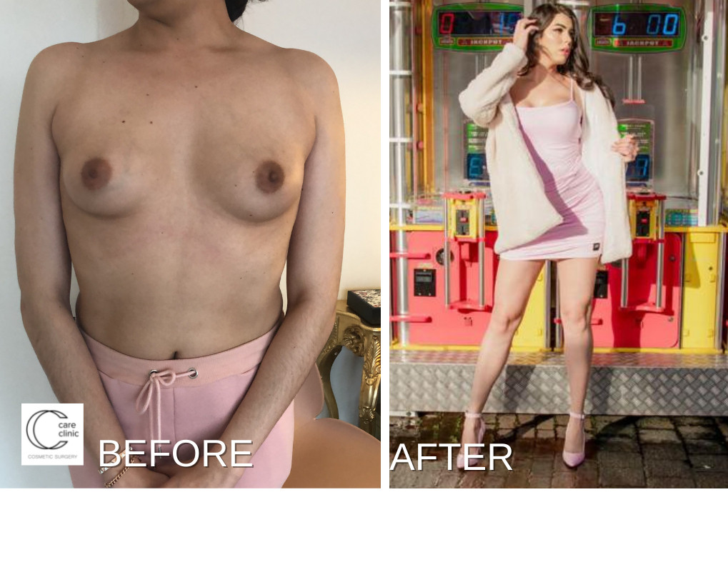 slide thumbnail 4