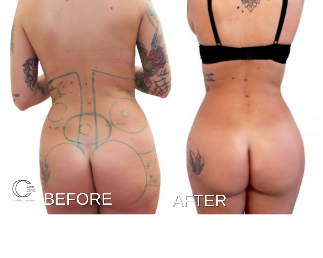 slide thumbnail 2