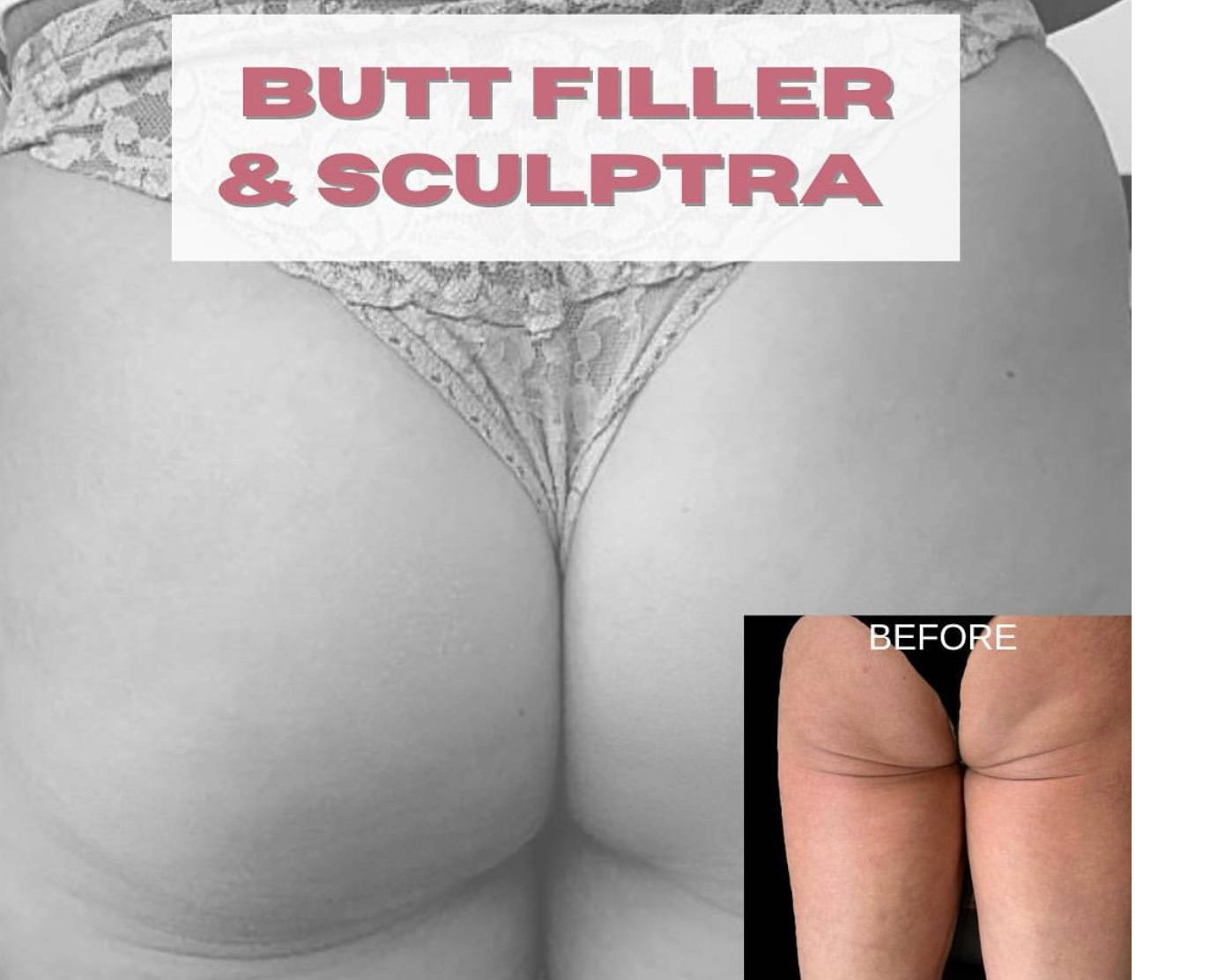 slide thumbnail 2