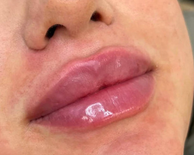 Faceland  - Merel van der Kooij