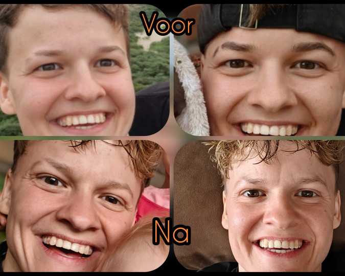 Review afbeelding