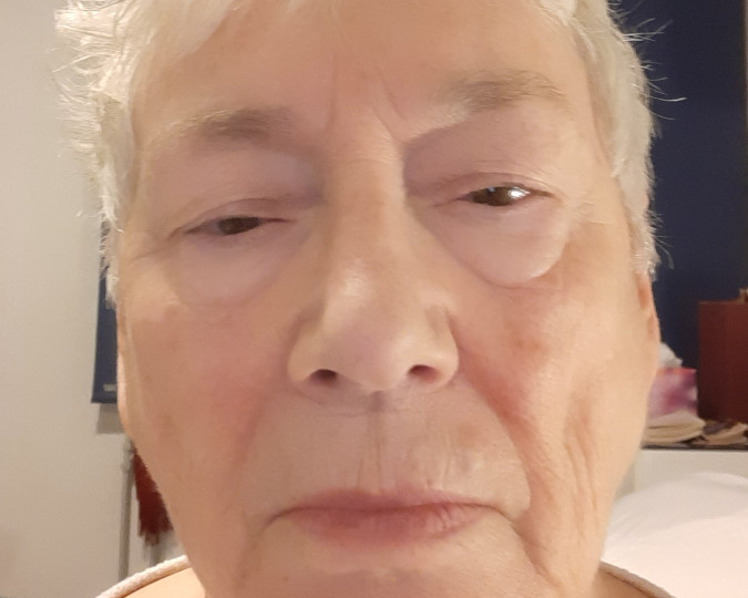 Review afbeelding