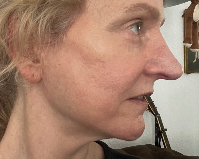 Review afbeelding