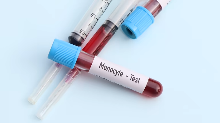 Учёные выявили ранний маркер возврата ВИЧ после прерывания терапии