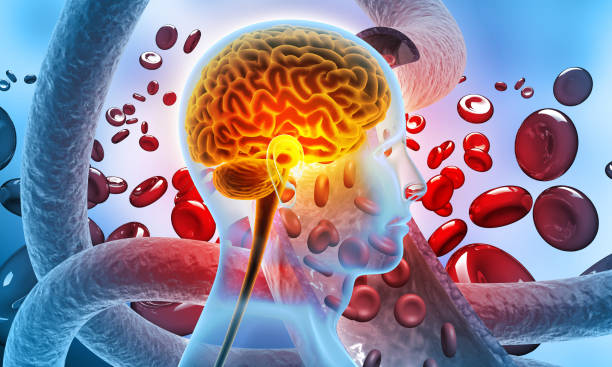 PML, имитирующая инсульт, у пациента с ВИЧ: клинический случай