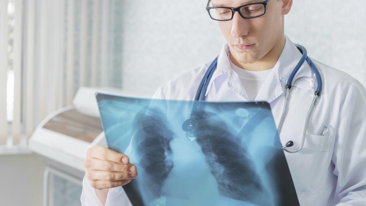 Study: Direct transmission drives drug-resistant TB epidemic - picture 1 Study: Direct transmission drives drug-resistant TB epidemic - picture 1