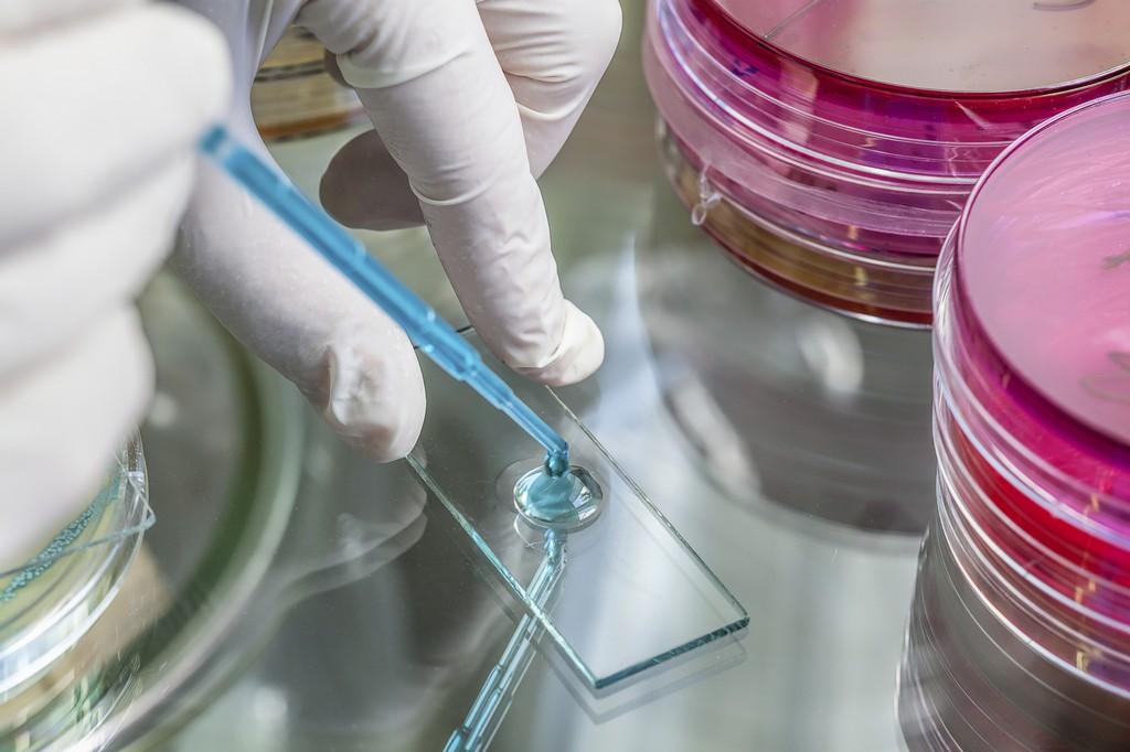 Increased syphilis screening boosts detection of early latent infections among Australian gay men - picture 1 Increased syphilis screening boosts detection of early latent infections among Australian gay men - picture 1