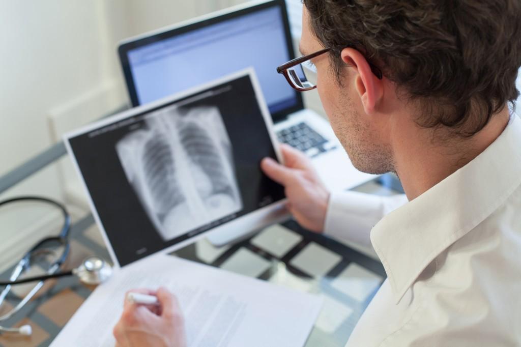 How HIV Is Correlated With Lung Diseases? - Bild 1 How HIV Is Correlated With Lung Diseases? - Bild 1