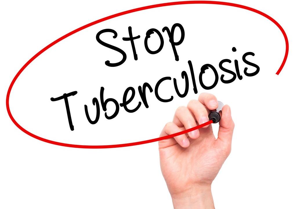 Tuberculosis to cost world economy $1 trillion by 2030, warns report - picture 1 Tuberculosis to cost world economy $1 trillion by 2030, warns report - picture 1