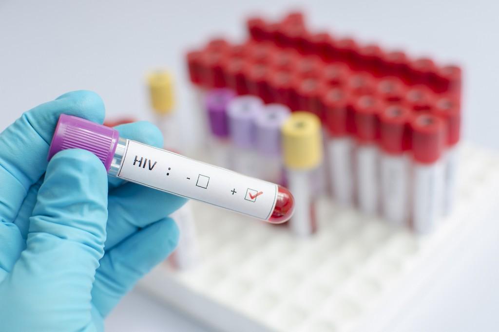 HCV therapy helps to reduce the risk of diabetes and chronic renal failure in HCV/HIV co-infected patients - picture 1 HCV therapy helps to reduce the risk of diabetes and chronic renal failure in HCV/HIV co-infected patients - picture 1