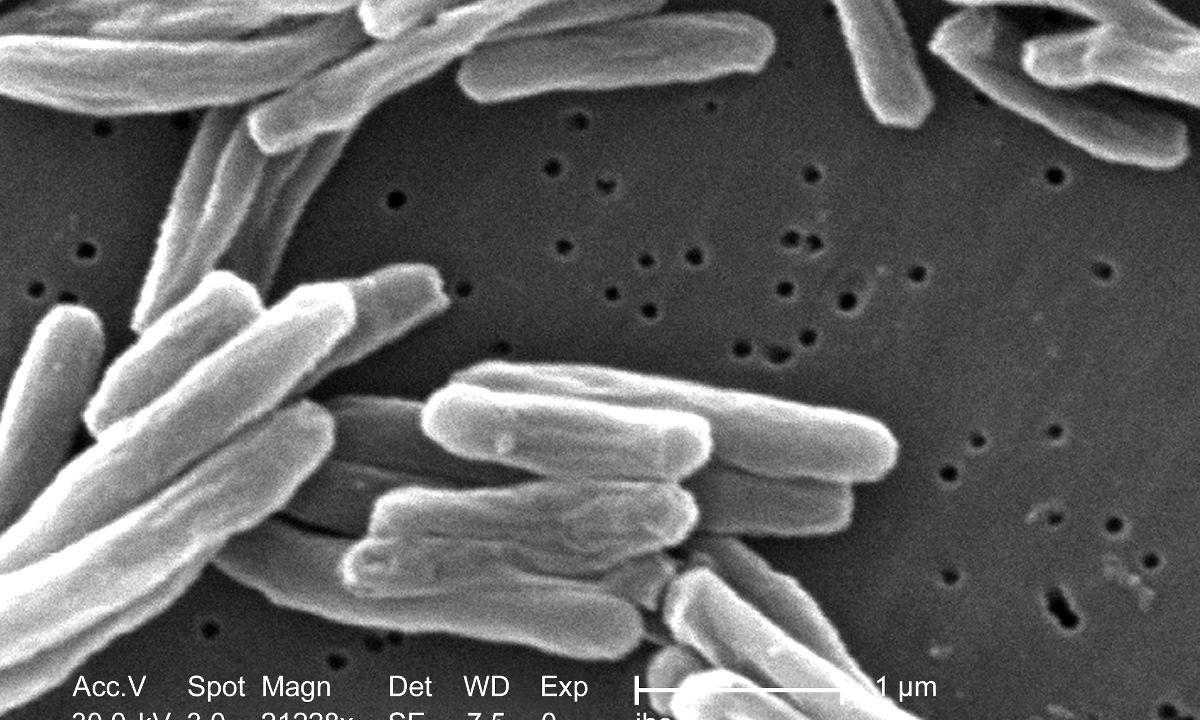New Drug Lead From Soil Bacteria Compound Identified To Fight Against Tuberculosis - picture 1 New Drug Lead From Soil Bacteria Compound Identified To Fight Against Tuberculosis - picture 1