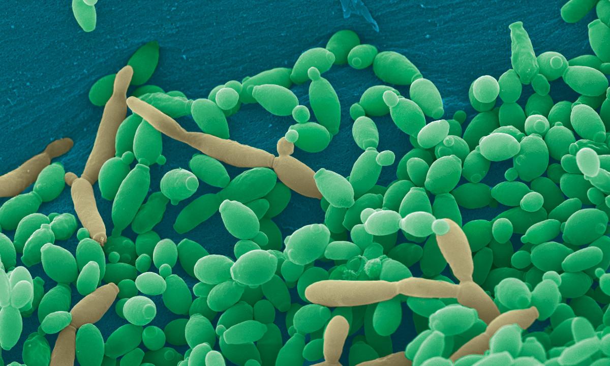 Several Strains of Сandida Proved To Be Resistant To All Available Antifungal Agents - picture 1 Several Strains of Сandida Proved To Be Resistant To All Available Antifungal Agents - picture 1