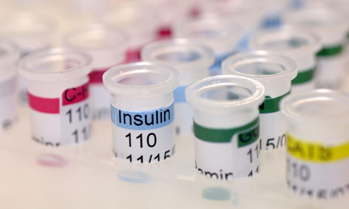 Insulin May Help Restore Neurocognitive Functions in HIV Patients - picture 1 Insulin May Help Restore Neurocognitive Functions in HIV Patients - picture 1